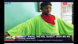 Terapi Bocah Obesitas Arya dari Bobot 192 Kg Susut Jadi 90 Kg - SIP 0601