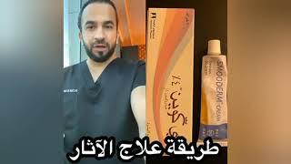 علاج اثار الحبوب في الوجه - دكتور طلال