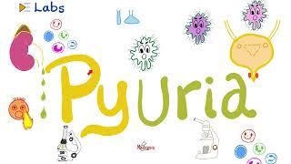 Pus in the Urine Pyuria - Urinary Tract Infections UTI - Urinalysis - Labs