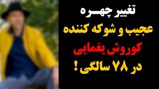 تغییر چهره عجیب و شوکه کننده کوروش یغمایی در ۷۸ سالگی 