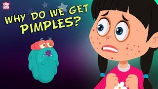 Why Do We Get Pimples? The Dr. Binocs Show  Best Learning Videos For Kids  Peekaboo Kidz