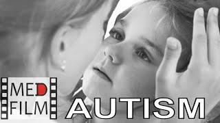 Аутичные дети. Лечение аутизма © Autistic children autism treatment