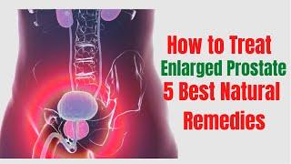 5 Natural Remedies For Enlarged Prostate - Prostate Enlargement Treatment