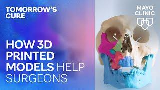 How 3D printed models help surgeons  Tomorrows Cure Clip