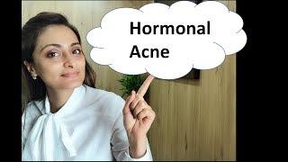 Hormonal Acne  Resistant Acne  Treatment  Dr. Aanchal Panth