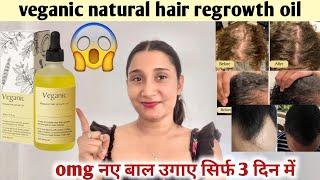 Veganic Natural Hair Growth Oil  Honest Review2024