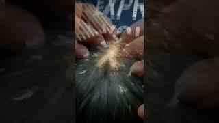 ASMR Dandruff Removal and Scratching 