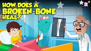 How Bone Fractures Heal?  How Does a Broken Bone Heal?  Process of Bone Healing  Dr. Binocs Show