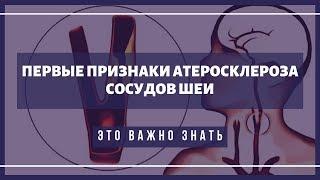 Первые симптомы атеросклероза сосудов шеи