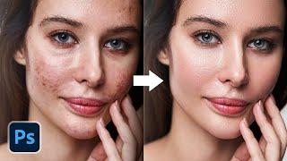 3 Superfast Ways to Auto-Repair Skin + Free Actions - Photoshop Tutorial
