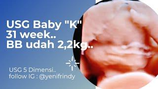 Usia Kehamilan 31 Minggu  Berat Bayi Over  USG 5 Dimensi