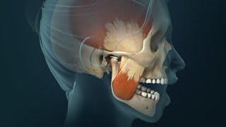 TMJ Pain Headaches Earaches and Spasms