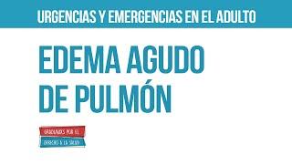 Edema Agudo de Pulmón  Urgencias y emergencias en el adulto