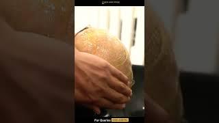 Hair Patch Fixing Method  #shorts #youtubeshorts