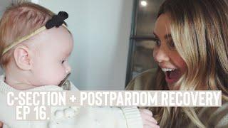 My Quick C-Section Recovery + Postpartum Depression Update  Vlog Ep.16  ellebangs