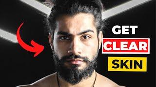 How to get clear skin - skincare for men how to get rid of acne