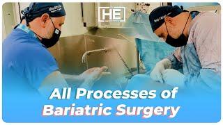 All Processes of Bariatric Surgery  Dr. Hasan Erdem