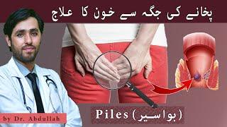 What is Hemorrhoids? 3 Common Bawaseer Ki Alamat In Urdu  Piles Bleeding Treatment At Home