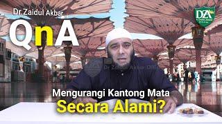 Mengurangi Kantong Mata Secara Alami? - dr. Zaidul Akbar Official