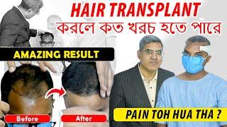 Best Hair Result in Kolkata    Pain in Hair Transplant    Cheapest Hair Transplant in Kolkata