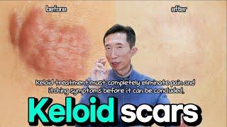 Keloid scars accompanied by symptoms and allergies.