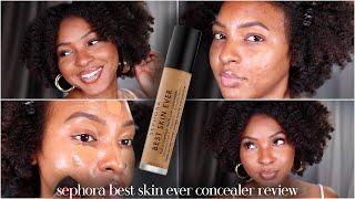 SEPHORA BEST SKIN EVER CONCEALER REVIEW ON ACNE PRONE SKIN  NEW IN SEPHORA  WEAR TEST  KENSTHETIC