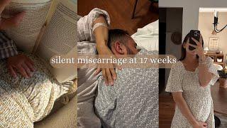 we lost our baby  silent miscarriage at 17 weeks