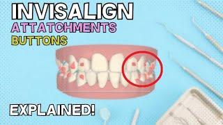 Invisalign Attachments and Buttons  How do they work? - Explained in 4 minutes