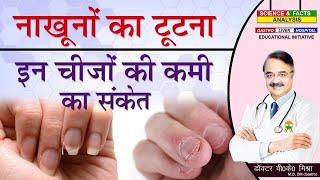 नाखूनों का टूटना इन चीजों की कमी का संकेत  WEAK NAILS HERE ARE SOME NUTRIENTS YOU LACK