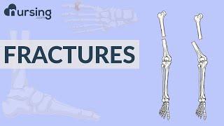 Fractures Nursing Care