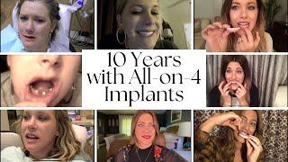 10 Years with Dental Implants