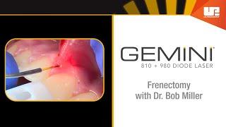 Frenectomy  How to Use the Gemini™ Laser