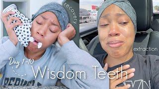 VLOG Wisdom Teeth Extraction  Removal + Recovery