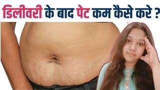 डिलीवरी के बाद पेट कम कैसे करें  How to Reduce Belly Fat After Pregnancy @Narijivan