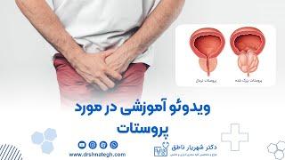 ویدئو آموزشی در مورد پروستات