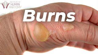 Skin Burns A LOT Faster Than You Think...