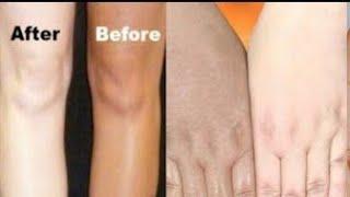 Sun Tan removed at home  How to get clear skin skin care  Ummi life #shorts #skincare