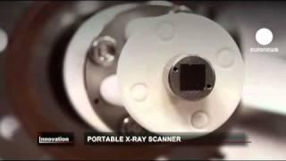 euronews innovation - Low-cost portable X-ray machine hits market