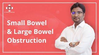 Small Bowel and Large Bowel Obstruction  Radiology