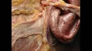 TP  temporo-parietal  flap for microtia - cadaver dissection