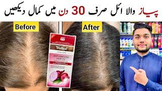 Wellice Anti Hair Loss Onion Hair Oil For Hair Growth & Stope Hair Fall