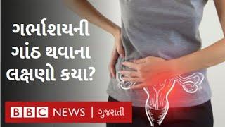 ગર્ભાશયની ગાંઠથી થઈ શકે છે આ તકલીફો શું છે ઉપચાર?