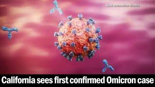 1st case of omicron variant identified in California