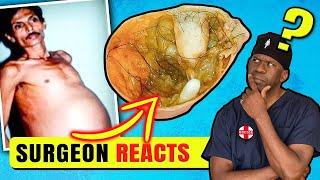 Surgeon Reacts To 7 STRANGEST Things Found INSIDE The Human Body Ep 1