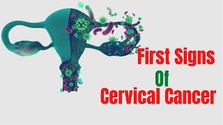 Signs Of Cervical Cancer Stage 1 - Symptoms For Cervical Cancer