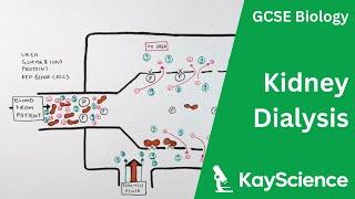 Kidney Dialysis - Biology GCSE  kayscience.com