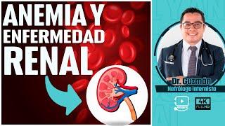 ANEMIA Y ENFERMEDAD RENAL - sintomas y tratamiento  Dr. Guzmán internista nefrólogo