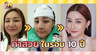 ศัลยกรรมทำดั้งซีรี่4และโมหน้าผาก ทำที่ไหน?เจ็บไหม?แพงไหม? มาดูกัน  M Busarakum Vlog.1