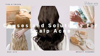 Causes and Solutions for Scalp Acne