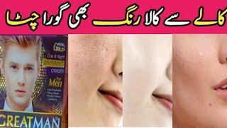 Great Man whitening Cream Review Whitening cream for Men